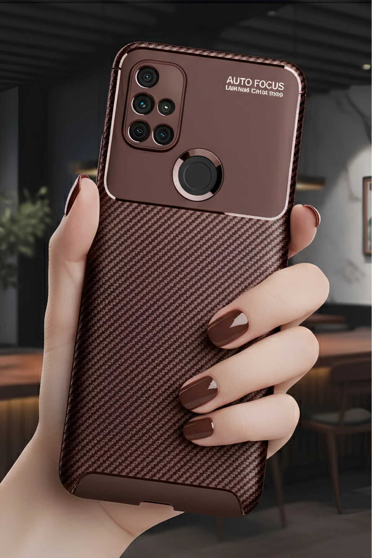 One Plus Nord N10 5G Kılıf Kamera Korumalı Darbe Emici Karbon Fiber Desenli Kapak
